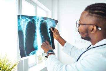 Male radiologist analyzing chest X-ray of an patient at medical clinic during coronavirus epidemic....