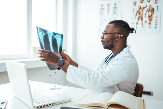 Male radiologist analyzing chest X-ray of an patient at medical clinic during coronavirus epidemic. Doctor with radiological chest x-ray film for medical diagnosis on patient's health on asthma