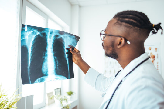 Doctor diagnosing patients health on asthma, lung disease, COVID-19 or bone cancer illness with radiological chest x-ray film for medical healthcare hospital service.