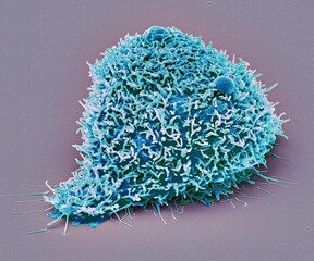 Kidney cancer cell, SEM