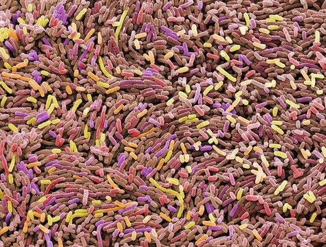 Ecoli bacteria, SEM