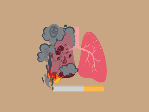 Illustration of human lungs - healthy and affected by cigarette smoke on color background