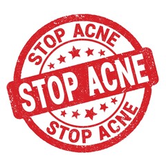 STOP ACNE text written on red round stamp sign.