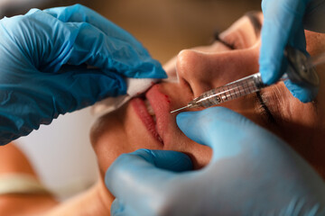 facial aesthetics, Lip augmentation. The specialist doctor makes injections into the lips.