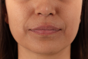 Close-up of female lips on white background before lip augmentation.
