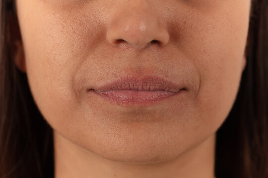 Close-up of female lips on white background before lip augmentation.
