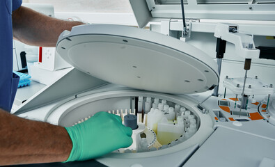 Diagnostic laboratory scientist in protective gloves working with biochemical automatic blood analyzer, close-up