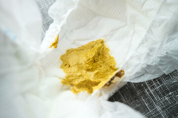 The dirty baby diaper full of sparse excrement, because the child has a diarrhea.
