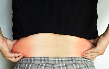 Individual postures show the back muscles that have subcutaneous fat around the waist.