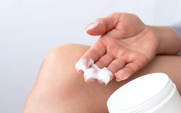 Close Up Of A Person Rubbing Cream For Healing Injured Knee Joint. Bruise On The Knee. Leg Pain.