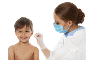 Doctor applying cream onto skin of little boy with chickenpox against white background. Varicella...