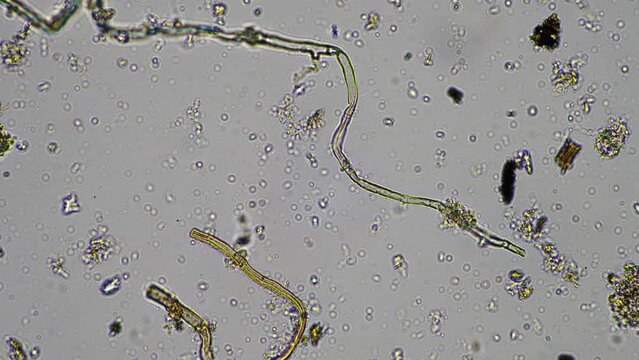 microorganisms and soil biology, with nematodes and fungi under the microscope