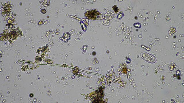 microorganisms and soil biology, with nematodes and fungi under the microscope