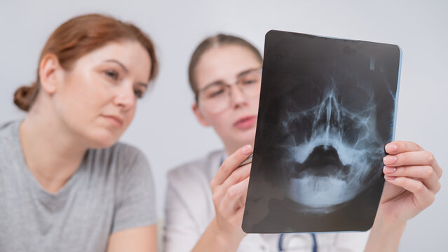 A woman doctor and a patient at the reception are discussing an x-ray of the sinuses.