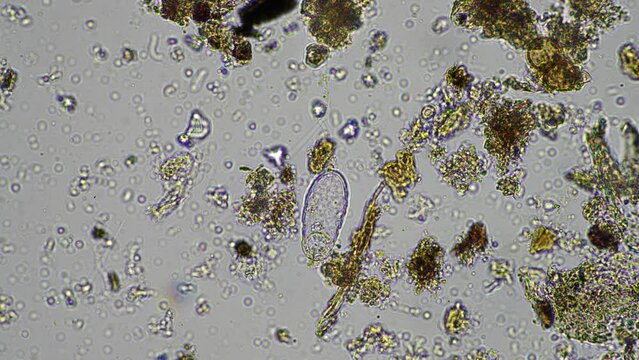 microorganisms and soil biology, with nematodes and fungi under the microscope