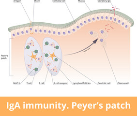 IgA immunity. Peyer’s patch. Lymphoid follicles of the small intestine generate IgA immune response with B cells, T cells, dendritic cells, and plasma cells secreting IgA.