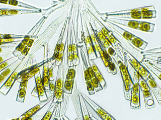 Licmophora sp. algae, marine and freshwater diatom under microscopic view. Genus of benthic,...