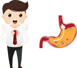 Gastro-Esophageal Reflux Disease (GERD)