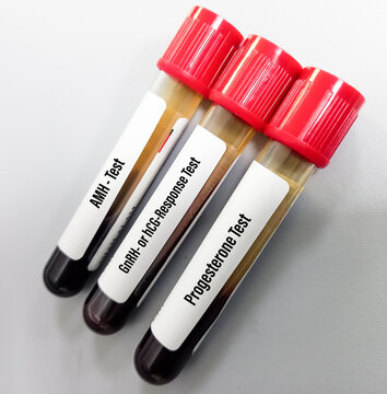 Blood sample of AMH, GnRH, Progesterone hormone test, Canine Reproductive Function Tests.