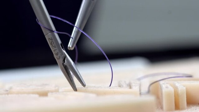 Close up of hands of surgeons team during operation uterus removal with surgical laparoscopy instruments. Gynecology. Team surgeon at work on laparoscopy operating in hospital. Close up.