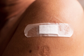 Medical adhesive plaster to stick wound on shoulder, arm close-up, wound healing guidelines