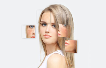 Dark spots, freckles,hyperpigmentation(melasma or chloasma),concept- skin lightening, skin whitening, Skin Brightening