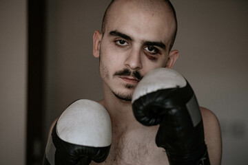 Young male with bruise under his eye with boxing gloves