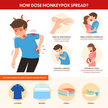 Infographics of how monkeypox outbreak can spread though?