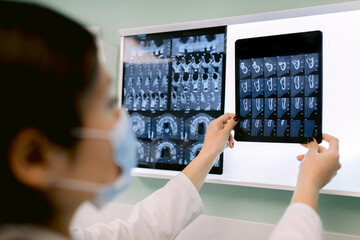 Crop dentist analyzing X ray image of teeth in hospital