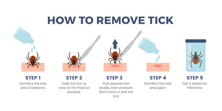 How to remove tick infographics banner, flat vector illustration on white background.