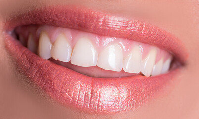 close up of lips with red lips. Smile. Smiling. Woman. Female. Dental. 
