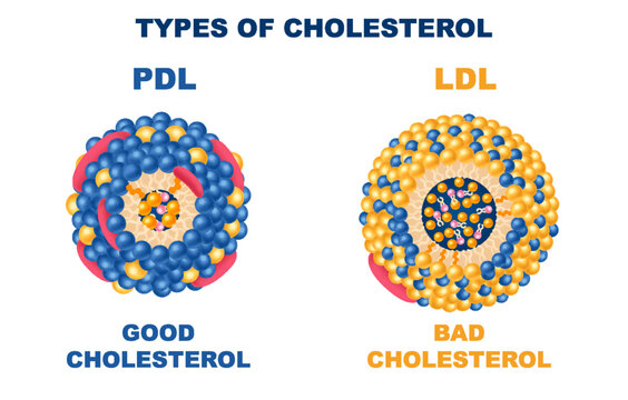 Cholesterol Types Set