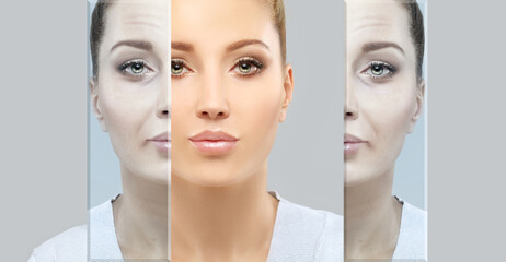 Effects of ageing,Frown scowl lines ,Nasolabial folds,Neck ,Under eye circles,neck lines. Plastic...