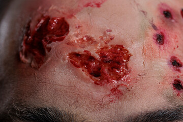 Scary halloween zombie with wounded forehead on camera, having dirty ugly bloody scars and...