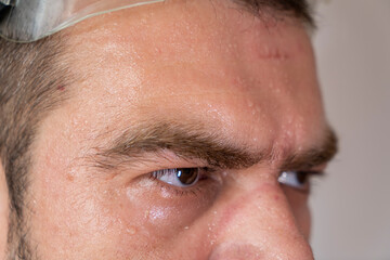 Sweaty, exhausted face with safety equipment marks.