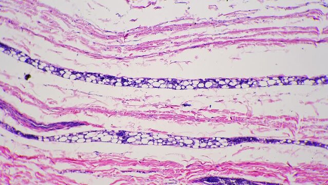Microscopic 100x view of human skin with shown sweat glands against bright field. Macro footage of epidermis layers multiply magnified for analyzing people perspiration process. Lab investigation