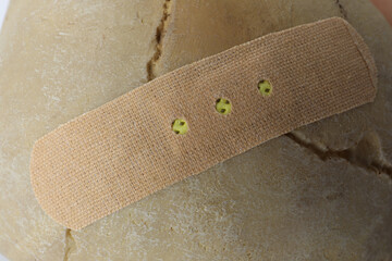 Beige sticking plaster on human skull, closeup