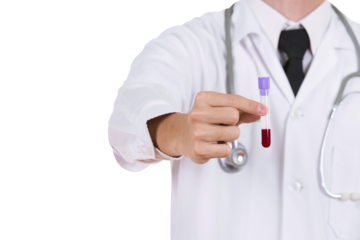 close up a medical test glass with blood