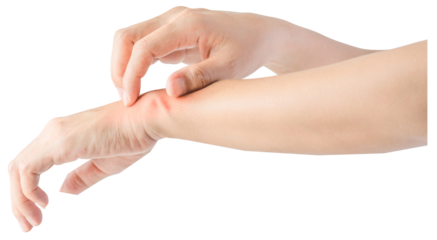 Woman scratching arms because of the itching.