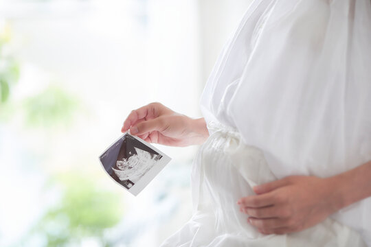 エコー写真を持つ妊婦