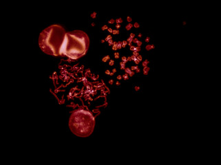 Chromosomes under fluorescence microscope, red colored Human chromosomes from blood