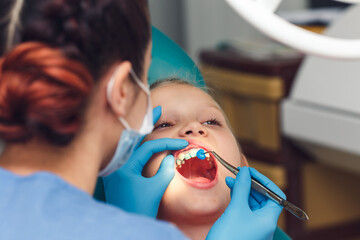dentist fluoridates a child's teeth. Strengthening of tooth enamel. - obrazy, fototapety, plakaty