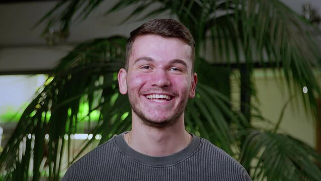 Close-up of a young man with pimples on his face. The guy laughs. Problematic skin