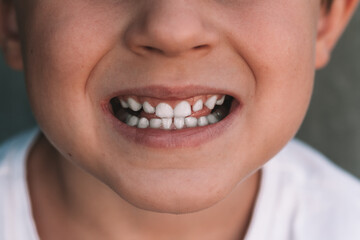 Horizontal portrait of children's white teeth. Dentistry and healthcare since childhood.