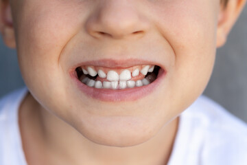 Horizontal portrait of children's white teeth. Dentistry and healthcare since childhood.