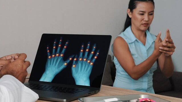 Doctor showing x-ray of pain in the joints of hands on a laptop with woman patient
