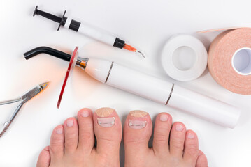 Рodologist (podiatrist) tools for titanium thread for nails. Polymerization UV lamp, tweezers, flowable composite gel, capolin, kinesiology tape and woman's feet. Isolated on white background.