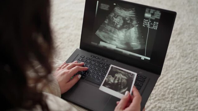 a young pregnant woman watches a video of an ultrasound of a child on a laptop and holds an ultrasound picture in her hands
