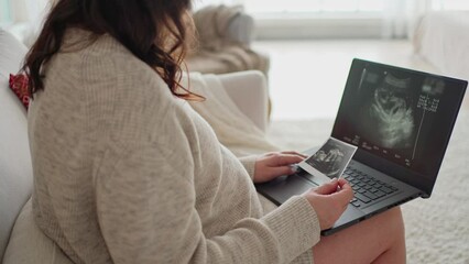 a young pregnant woman sits on a sofa and watches a video of an ultrasound of her unborn child on a laptop