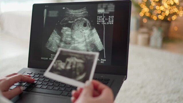 in female hands a laptop with a video and photo of the ultrasound of the unborn child